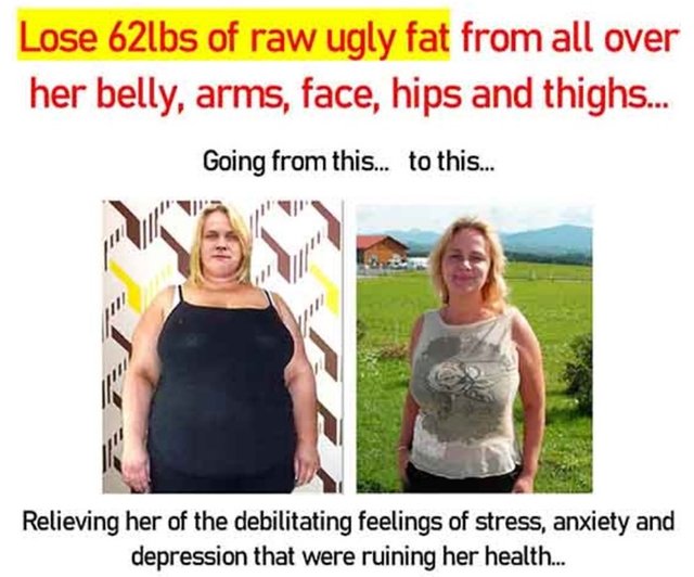 lose 62 lbs of raw fat with leptin advantage supplement.jpg