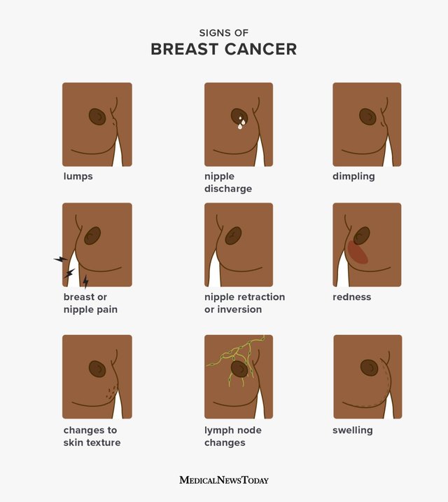 3319-breast-cancer-symptoms-english-1296x728-body.20210323201926188.jpg