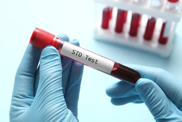 6 Things You Should Know Before Getting an STD Test.jpg