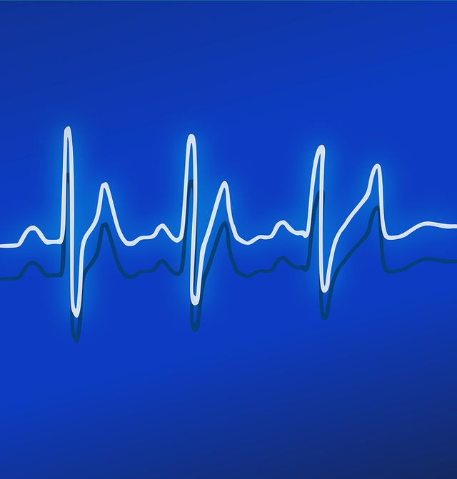 ekg-158177_960_720.png