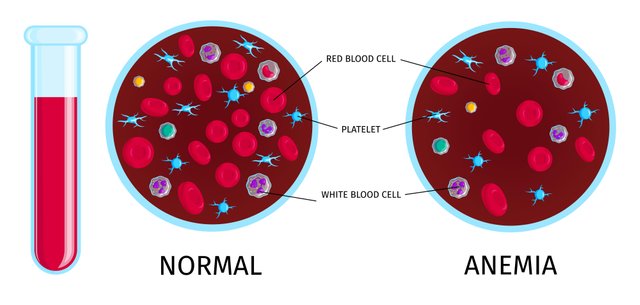 17714220_2012.i504.012.blood_cells_anemia.jpg