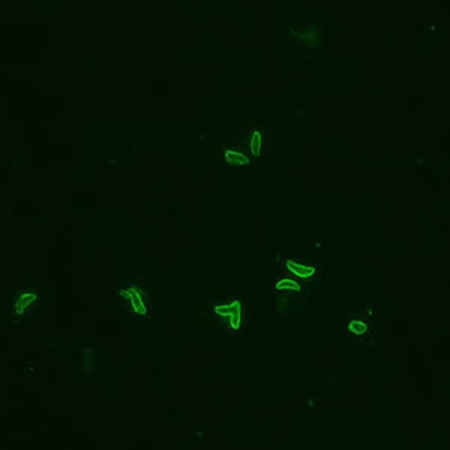 ToxoTachyzoites Green  Formalin-fixed T. gondii tachyzoites stained by immunofluorescence cdc public.jpg