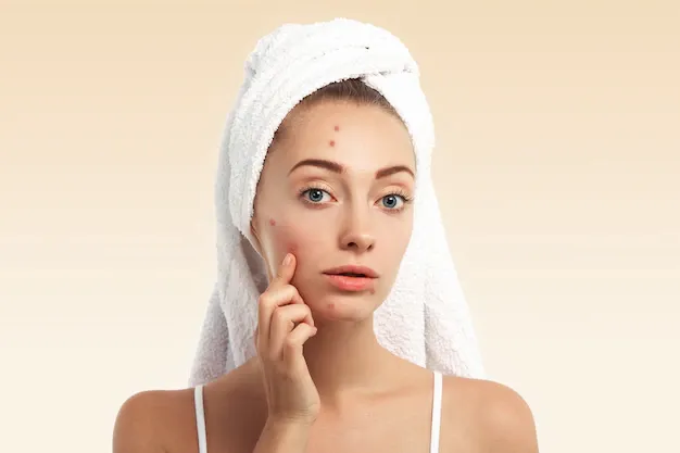 closeup-young-woman-with-towel-head-pimples-face_273609-14430.webp