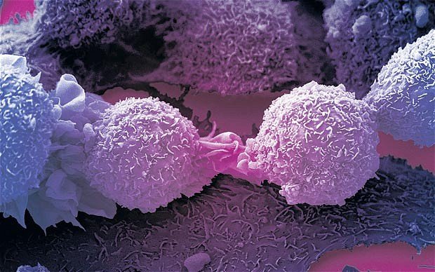 Cancer-cell-new.jpg