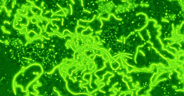 action-sn-blog-cyanobacteria.jpg