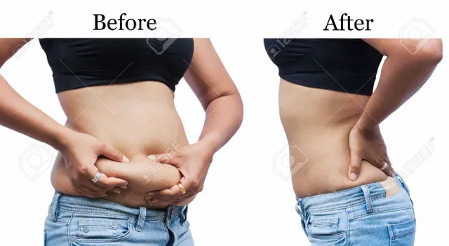 44341043-women-body-fat-belly-between-before-and-after-weight-loss.webp