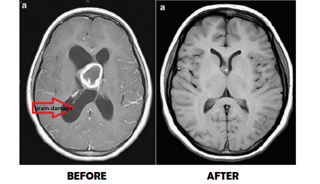 Before&After_ForoughiA.png