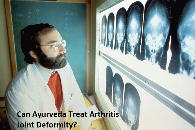 neeraj arthritis treatment 4.jpg