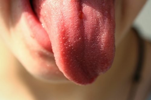 tongue-822441_1280-e1543505069708.jpg