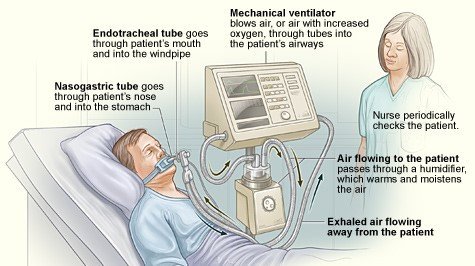 Ventilators_feat.jpg