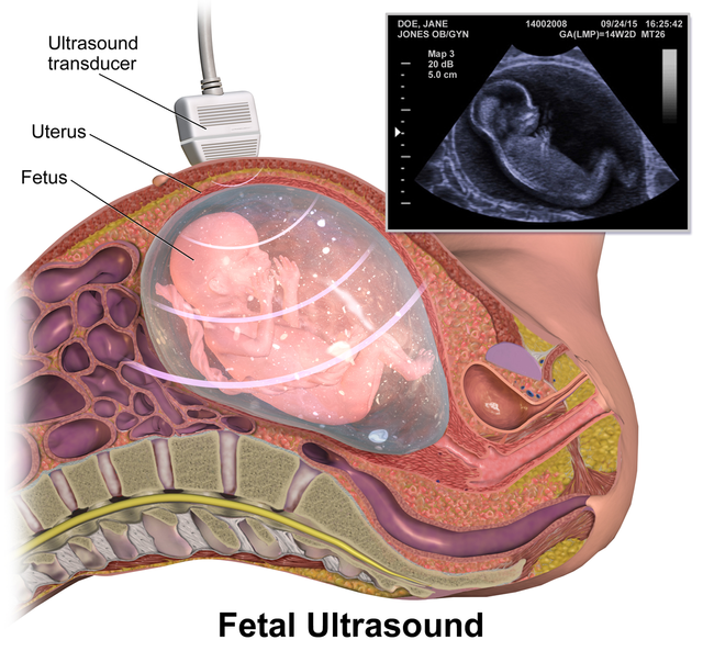 Fetal_Ultrasound.png