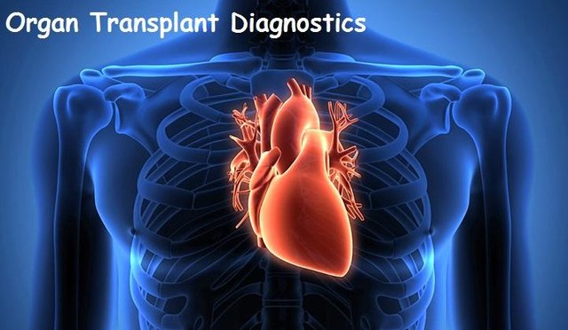 Transplant Diagnostics Market1.jpg