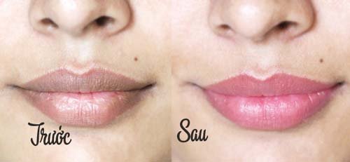 kem dưỡng môi trị thâm Lansley Beauty Lip Balm-3.jpg