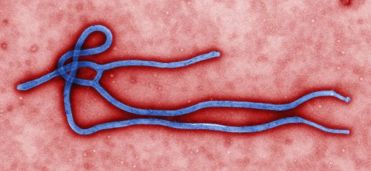 Ebola virus_virion CDC Cynthia Goldsmith public.jpg