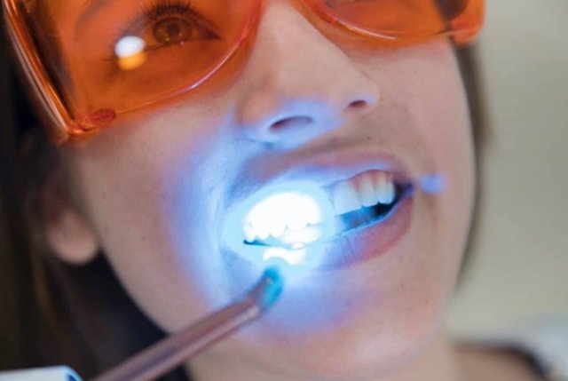 10 Myths About Teeth Whitening.jpg