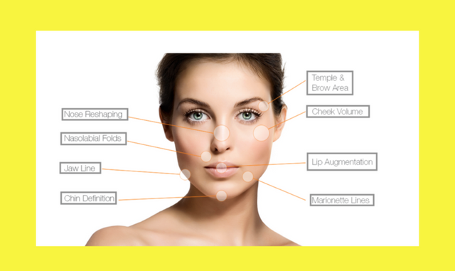 Where-do-the-dermal-fillers-go-to--768x457.png