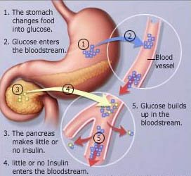 diabetesccf.jpg