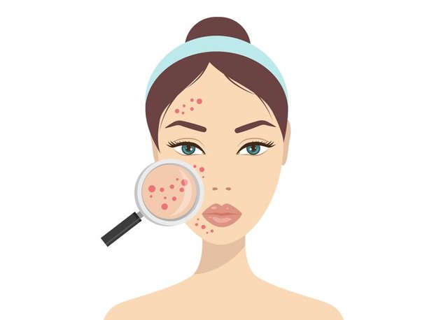 acne-skin-problems-woman-holding-magnifying-glass-looking-cystic-acne-her-facial-vector-illustration-about-skin-problem-concept_101969-803.jpg