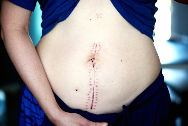 abdomen-belly-body-2007568.jpg