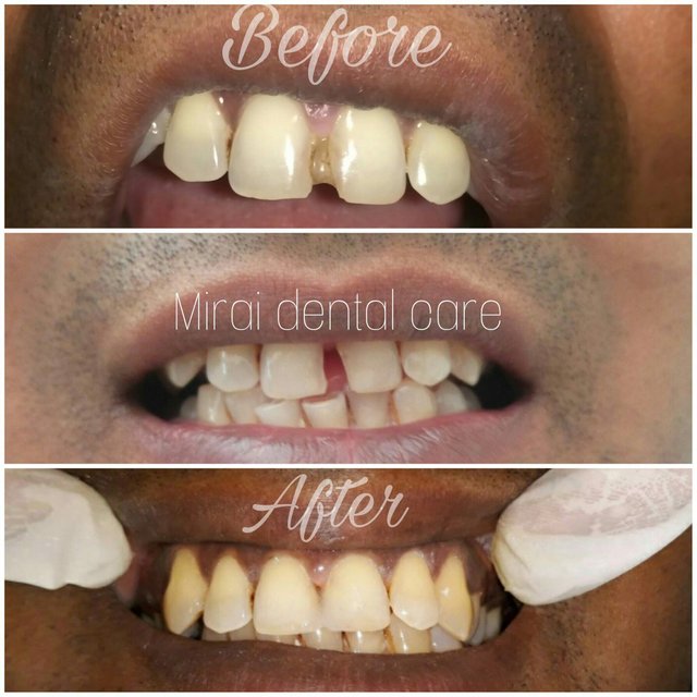 mirai-dental-care-and-implant-centre-virar-west-palghar-dentists-vs4iu.jpg