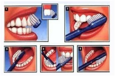 Las-mejores-técnicas-para-un-cepillado-de-dientes-correcto-11.jpg