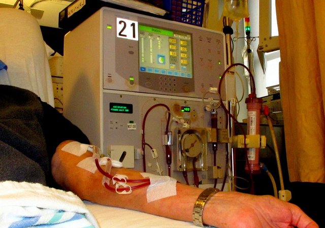 Dialysis_-_arm_-_01 (1).jpg