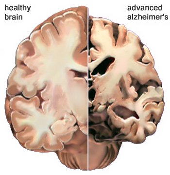 cnv-vital-brain-50718.jpeg