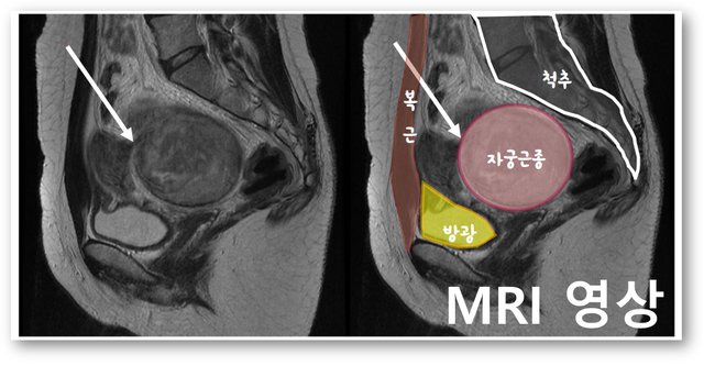 MRI 영상.jpg