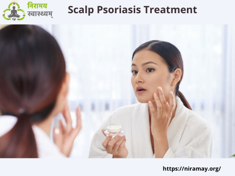Scalp Psoriasis Treatment.png