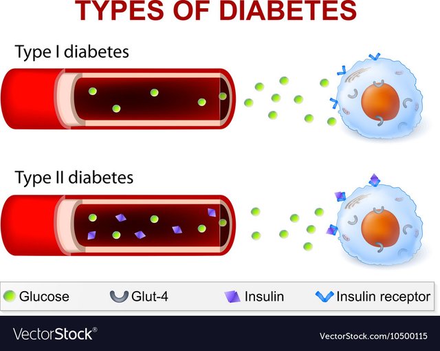 diabetes-type-1-and-type-2-vector-10500115.jpg