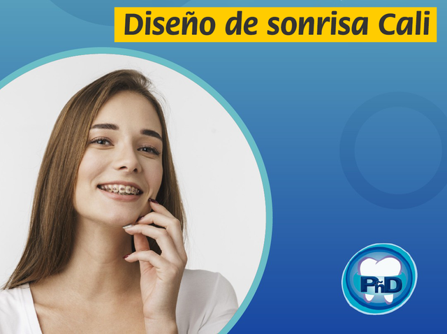 Diseño de sonrisa Cali.png