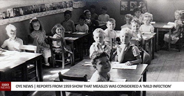 1959-reports-show-measles-mild-infection.jpg