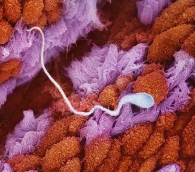 Sperm in the Fallopian tube.jpg