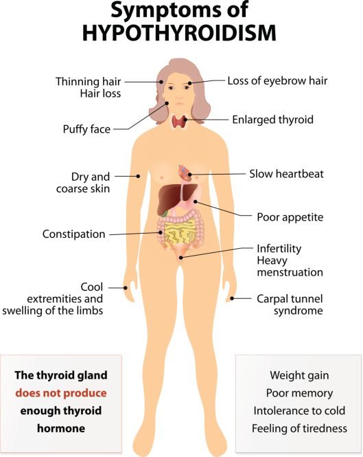Symptoms-of-Hypothyroidism.jpg