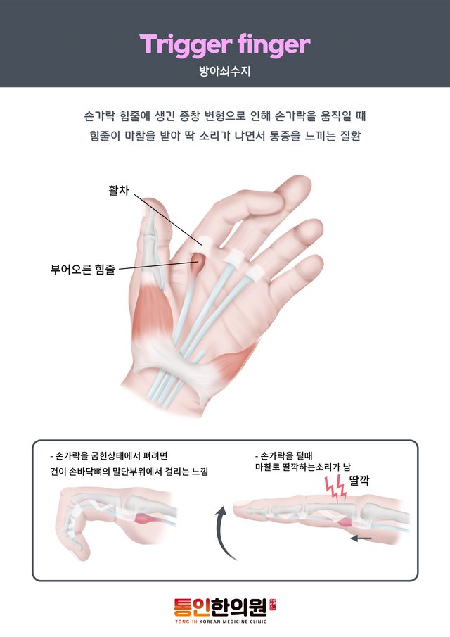 탄발지.jpg