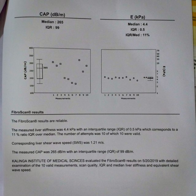Fibroscan.jpg