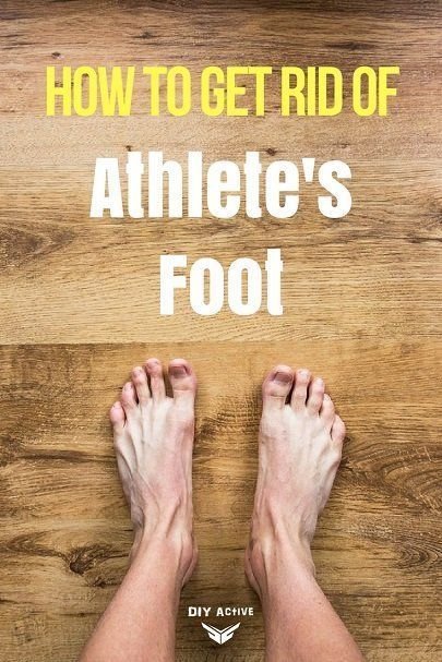 Try these home remedies to treat your athlete's foot!.jpeg