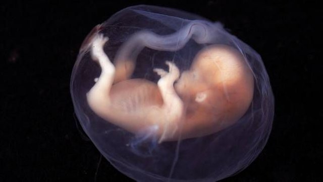 fetus_jpg_653x0_q80_crop-smart.jpg