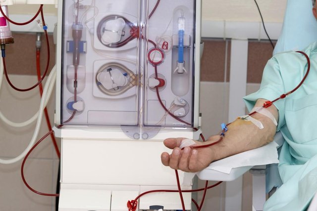 dialysis-can-carry-out-the-function-of-the-kidneys.jpg