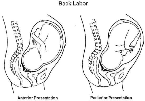 Back-Labor-1.jpg