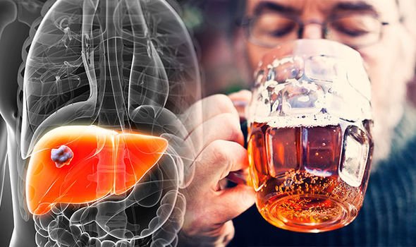 Liver-damage-Drinking-this-much-alcohol-a-day-can-lead-to-organ-failure-982734.jpg