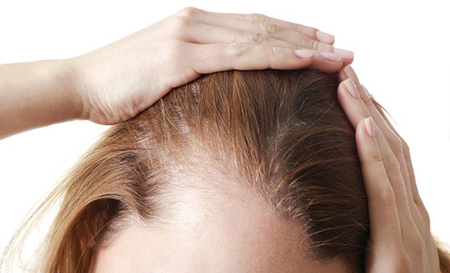 5 Reasons Women Are Saying Yes to Hair Transplants and Loving the Results!.jpg