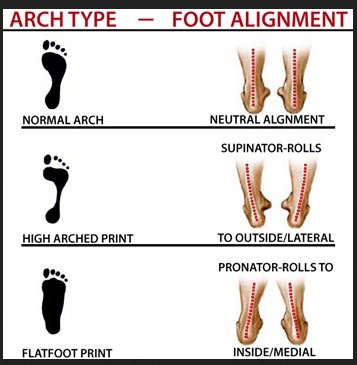 arch type foot.jpg