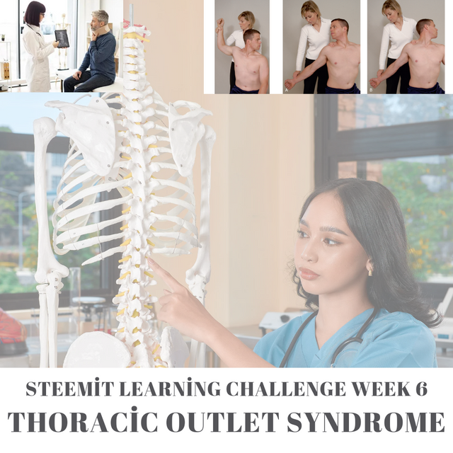 burnout syndrome symptoms instagram post _20250119_212323_0000.png
