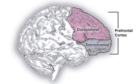 Prefrontal_cortex NIH public4.jpg