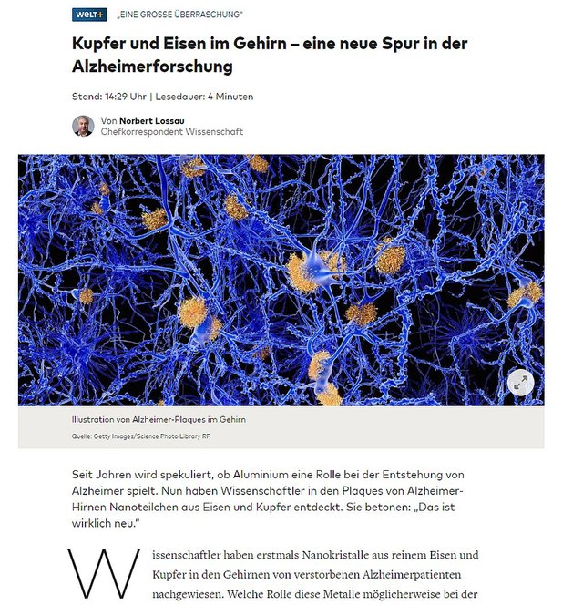 Kupfer und Eisen im Gehirn – eine neue Spur in der Alzheimerforschung.jpg