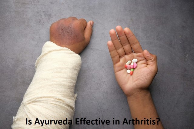 neeraj best arthritis ayurvedic treatment (3).jpg