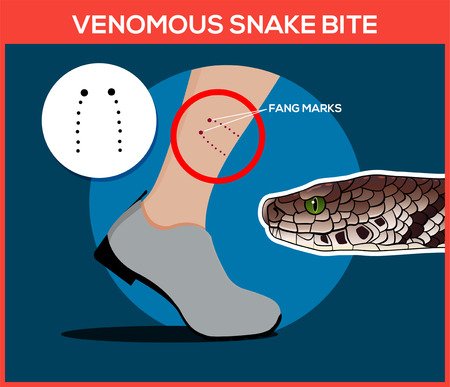 77096835-venomous-snake-bite-in-the-leg-snakebite-beware-of-snakes-flat-vector-illustrations.jpg