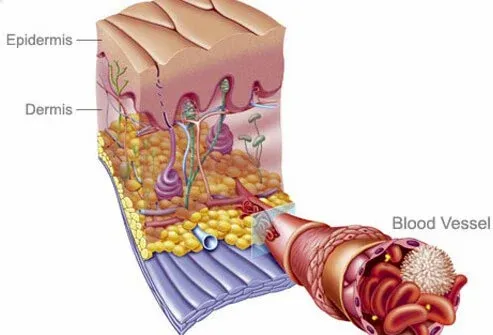 smoking-effects-pictures-s14.webp