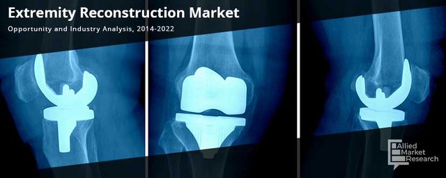 Extremity Reconstruction Market.jpeg